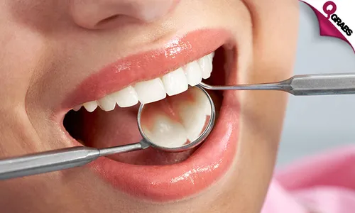 Dental Scaling, Polishing, Tooth Filling & More!